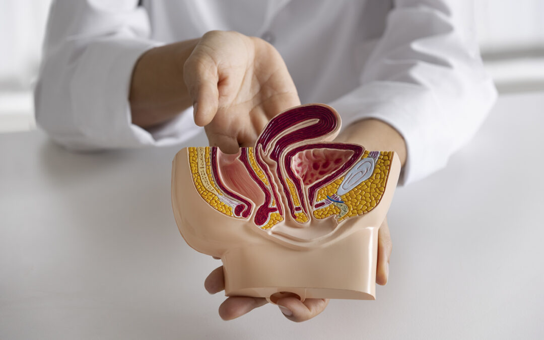 Causas, Síntomas y Tratamiento de las Hemorroides